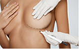 Breast Reconstruction